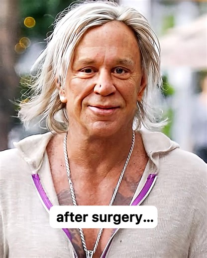 Extreme plastic surgery fails😳#interesting | Weirdee