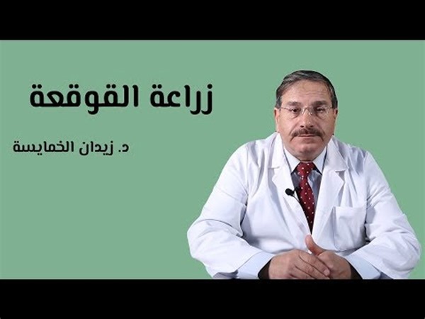 عملية زراعة القوقعة وأهم الشروط للقيام بالعملية