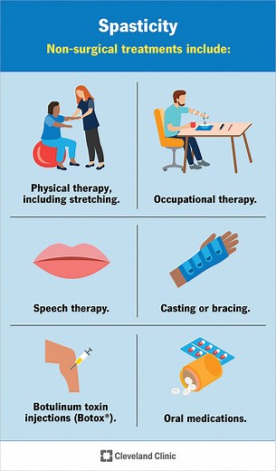 Spasticity: What It Is, Causes, Symptoms & Treatment