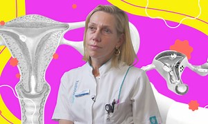 Zes vragen aan de gynaecoloog over ‘vrouwenziekte’ endometriose: ‘Een onderschat probleem’