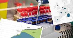 OVERZICHT. Het coronavirus wereldwijd en in België in kaart en grafiek