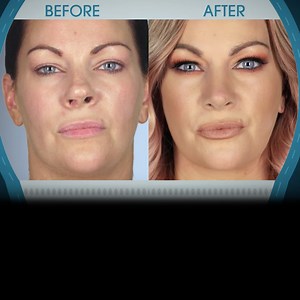 Botched Before & After: See the Show's Most Shocking Transformations