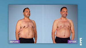 This patient ditched the social distancing salamis for the silver fox life. 😍 The Botched doctors helped fix a previous surgery gone wrong and gave Chase a newfound confidence. | E! Entertainment