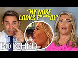 “British Demi Moore's” Nose COLLAPSED After YEARS of Cocaine Use (Before & After) | Botched | E!